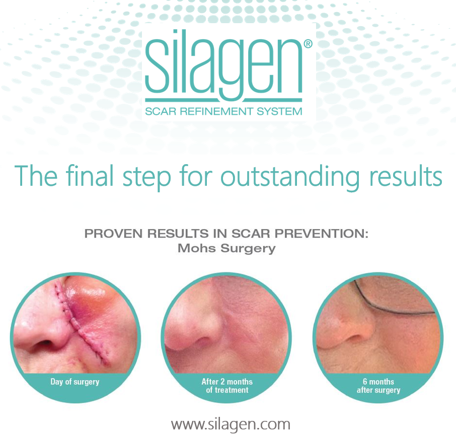 Silagen 100% Pure Gel - 15g