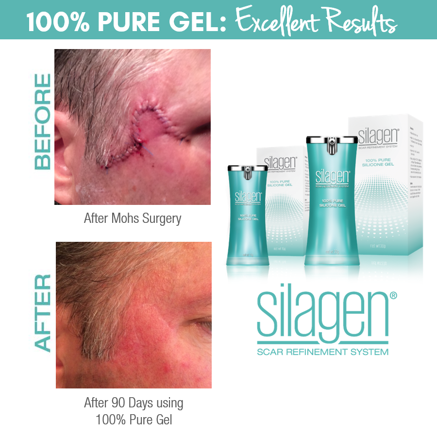 Silagen 100% Pure Gel - 15g